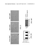 METHODS OF MODULATING ANGIOGENESIS VIA TRPV4 diagram and image