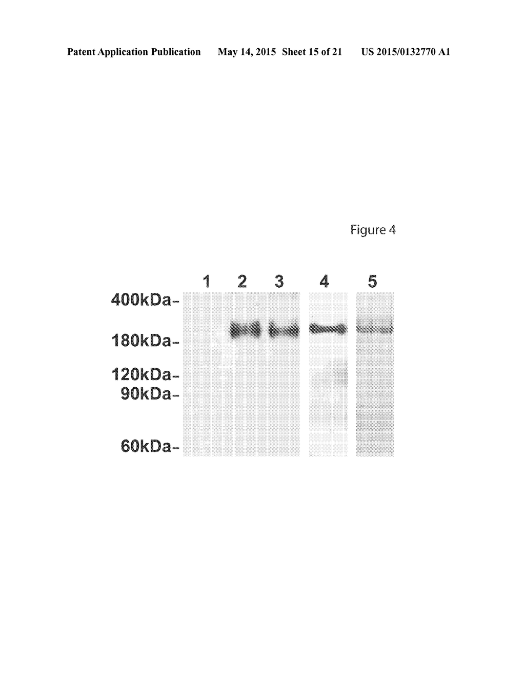 PREGNANCY-ASSOCIATED PLASMA PROTEIN-A2 (PAPP-A2) POLYNUCLEOTIDES - diagram, schematic, and image 16