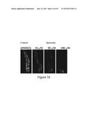 COMPOSITIONS FOR TREATING OR PREVENTING OBESITY AND INSULIN RESISTANCE     DISORDERS diagram and image