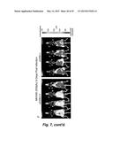 BROAD ANTIVIRAL THERAPY WITH MEMBRANE MODIFYING OXYSTEROLS diagram and image