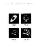 Treatment of CNS Disorders Associated with Mutations in Genes Encoding     Lysosomal Enzymes diagram and image