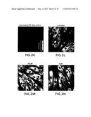 Treatment of CNS Disorders Associated with Mutations in Genes Encoding     Lysosomal Enzymes diagram and image