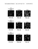 Treatment of CNS Disorders Associated with Mutations in Genes Encoding     Lysosomal Enzymes diagram and image