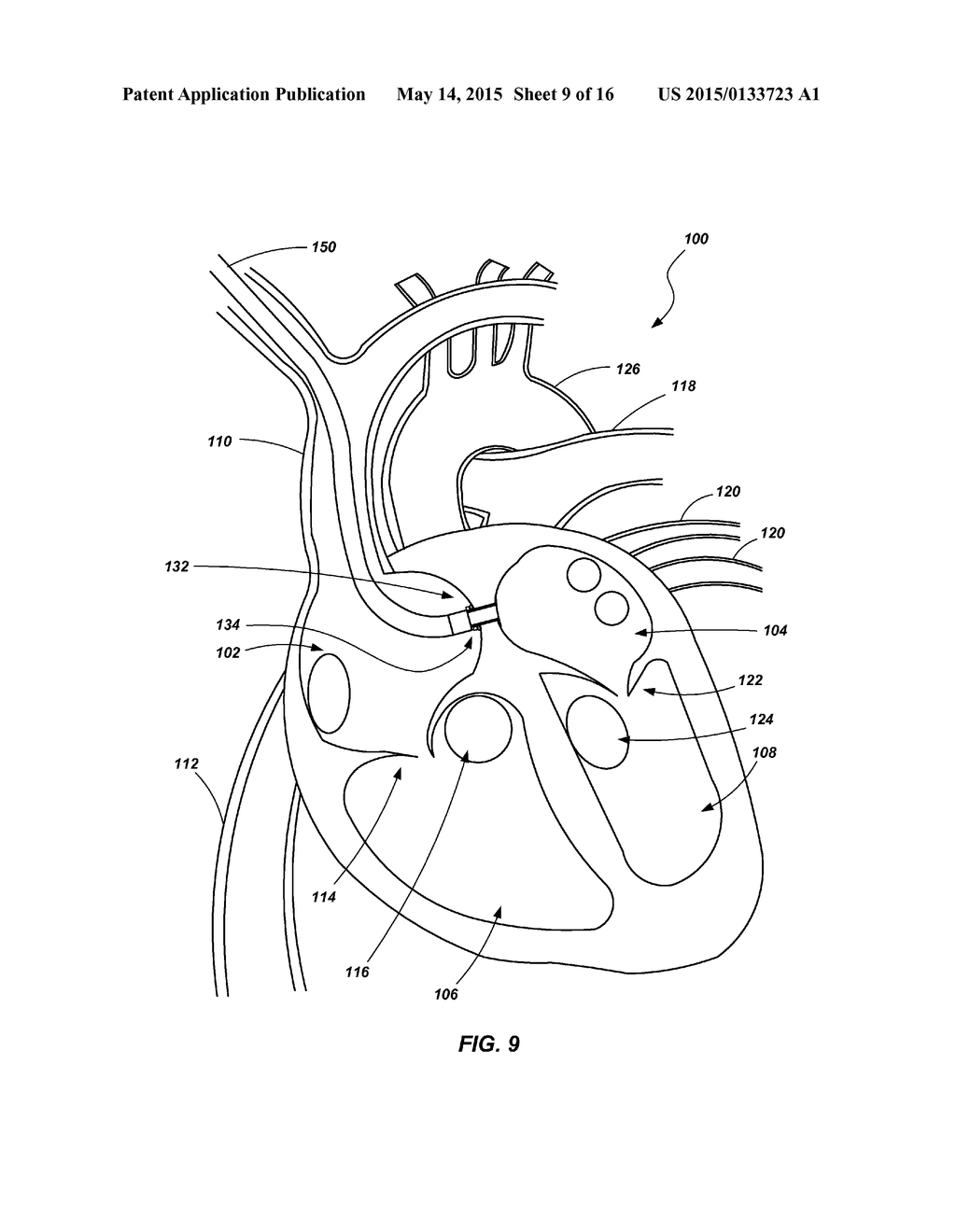 VENTRICULAR ASSIST DEVICE AND RELATED METHODS - diagram, schematic, and image 10