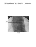 ENDOSCOPIC FUSION SYSTEM AND METHOD WITH NEUROMONITORING diagram and image