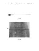 ENDOSCOPIC FUSION SYSTEM AND METHOD WITH NEUROMONITORING diagram and image