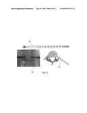 ENDOSCOPIC FUSION SYSTEM AND METHOD WITH NEUROMONITORING diagram and image