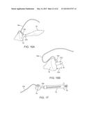 APPARATUS AND METHODS FOR ACCESSING AND SEALING BODILY VESSELS AND     CAVITIES diagram and image