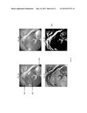 SYSTEM AND METHOD FOR INTRAOPERATIVE DETECTION OF CANCER MARGINS USING     CONFORMAL FILTERS IN A DUAL POLARIZATION CONFIGURATION diagram and image