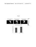 POSITRON EMISSION TOMOGRAPHY PROBE TO MONITOR SELECTED SUGAR METABOLISM IN     VIVO diagram and image