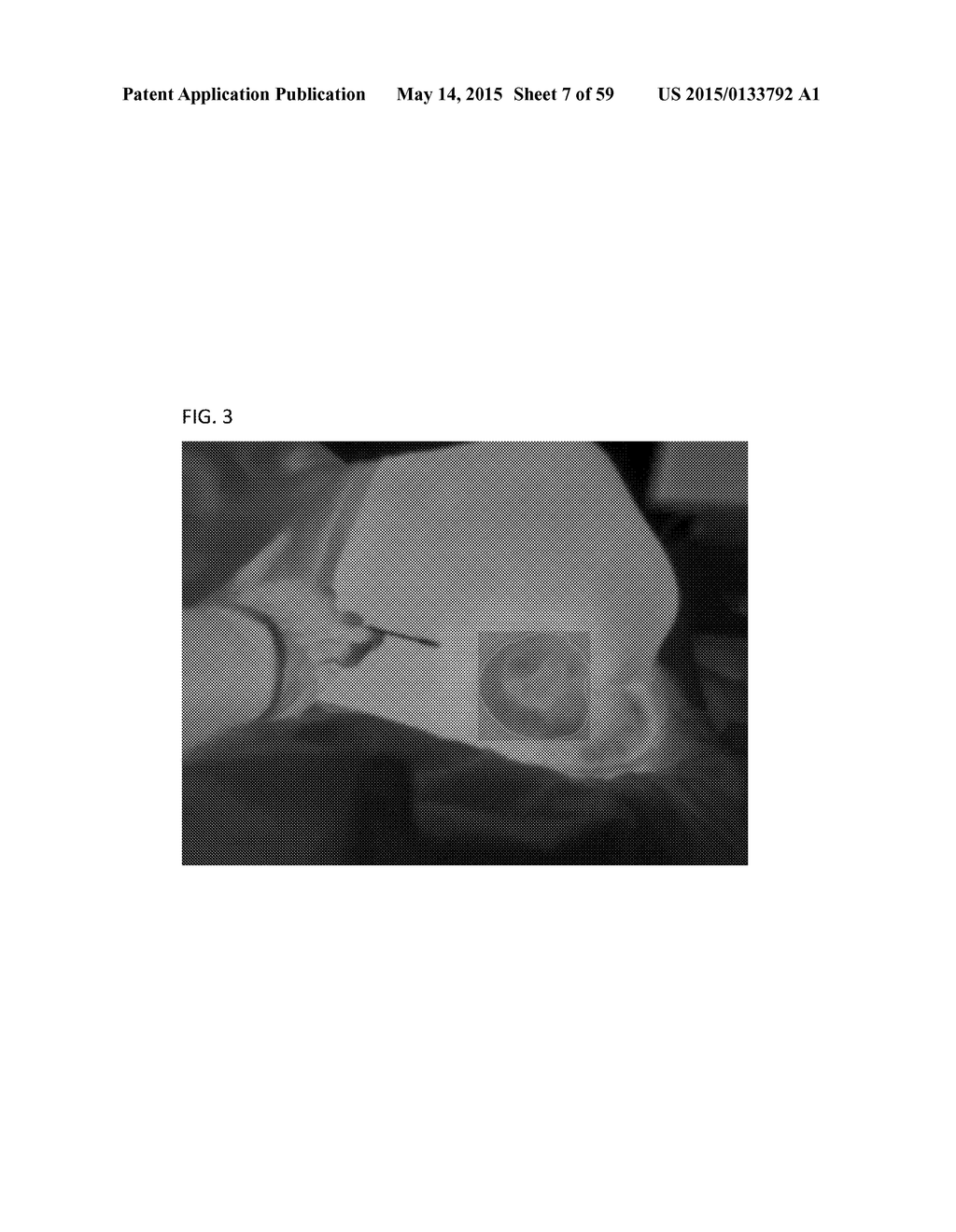 Method of Detecting Potential Deep Tissue Injury - diagram, schematic, and image 08