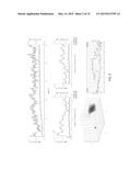 SYSTEM AND METHOD FOR RISK STRATIFICATION BASED ON DYNAMIC  NONLINEAR     ANALYSIS AND COMPARISON OF CARDIAC REPOLARIZATION WITH OTHER     PHYSIOLOGICAL SIGNALS diagram and image