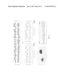 SYSTEM AND METHOD FOR RISK STRATIFICATION BASED ON DYNAMIC  NONLINEAR     ANALYSIS AND COMPARISON OF CARDIAC REPOLARIZATION WITH OTHER     PHYSIOLOGICAL SIGNALS diagram and image