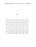 NONINVASIVE ATRIAL ACTIVITY ESTIMATION SYSTEM AND METHOD diagram and image