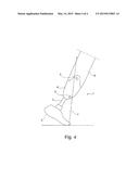 DEVICE AND METHOD FOR DETERMINING AN INCORRECT POSITIONING IN THE     ALIGNMENT OF PROSTHESES diagram and image