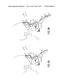 CERVICAL COLLAR WITH INDEPENDENT HEIGHT AND CIRCUMFERENCE ADJUSTABILITY diagram and image