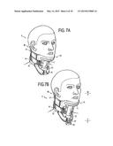 CERVICAL COLLAR WITH INDEPENDENT HEIGHT AND CIRCUMFERENCE ADJUSTABILITY diagram and image