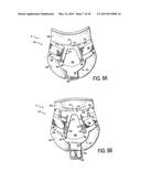 CERVICAL COLLAR WITH INDEPENDENT HEIGHT AND CIRCUMFERENCE ADJUSTABILITY diagram and image