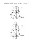 CERVICAL COLLAR WITH INDEPENDENT HEIGHT AND CIRCUMFERENCE ADJUSTABILITY diagram and image