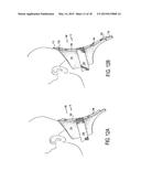 CERVICAL COLLAR WITH INDEPENDENT HEIGHT AND CIRCUMFERENCE ADJUSTABILITY diagram and image