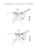 CERVICAL COLLAR WITH INDEPENDENT HEIGHT AND CIRCUMFERENCE ADJUSTABILITY diagram and image