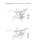 CERVICAL COLLAR WITH INDEPENDENT HEIGHT AND CIRCUMFERENCE ADJUSTABILITY diagram and image