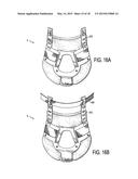 CERVICAL COLLAR WITH INDEPENDENT HEIGHT AND CIRCUMFERENCE ADJUSTABILITY diagram and image