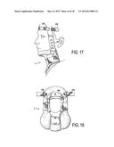 CERVICAL COLLAR WITH INDEPENDENT HEIGHT AND CIRCUMFERENCE ADJUSTABILITY diagram and image