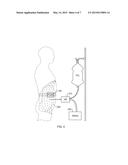 SYSTEM AND METHOD OF MONITORING AND CONTROL OF ULTRAFILTRATION VOLUME     DURING PERITONEAL DIALYSIS USING SEGMENTAL BIOIMPEDANCE diagram and image