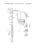 AUXILIARY INSERTION AND REMOVAL DEVICE diagram and image