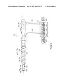 AUXILIARY INSERTION AND REMOVAL DEVICE diagram and image