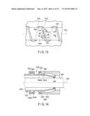 AUXILIARY INSERTION AND REMOVAL DEVICE diagram and image