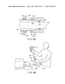 AUXILIARY INSERTION AND REMOVAL DEVICE diagram and image