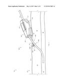 SYSTEMS AND METHODS FOR ANCHORING MEDICAL DEVICES diagram and image