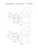 SYSTEMS AND METHODS FOR ANCHORING MEDICAL DEVICES diagram and image