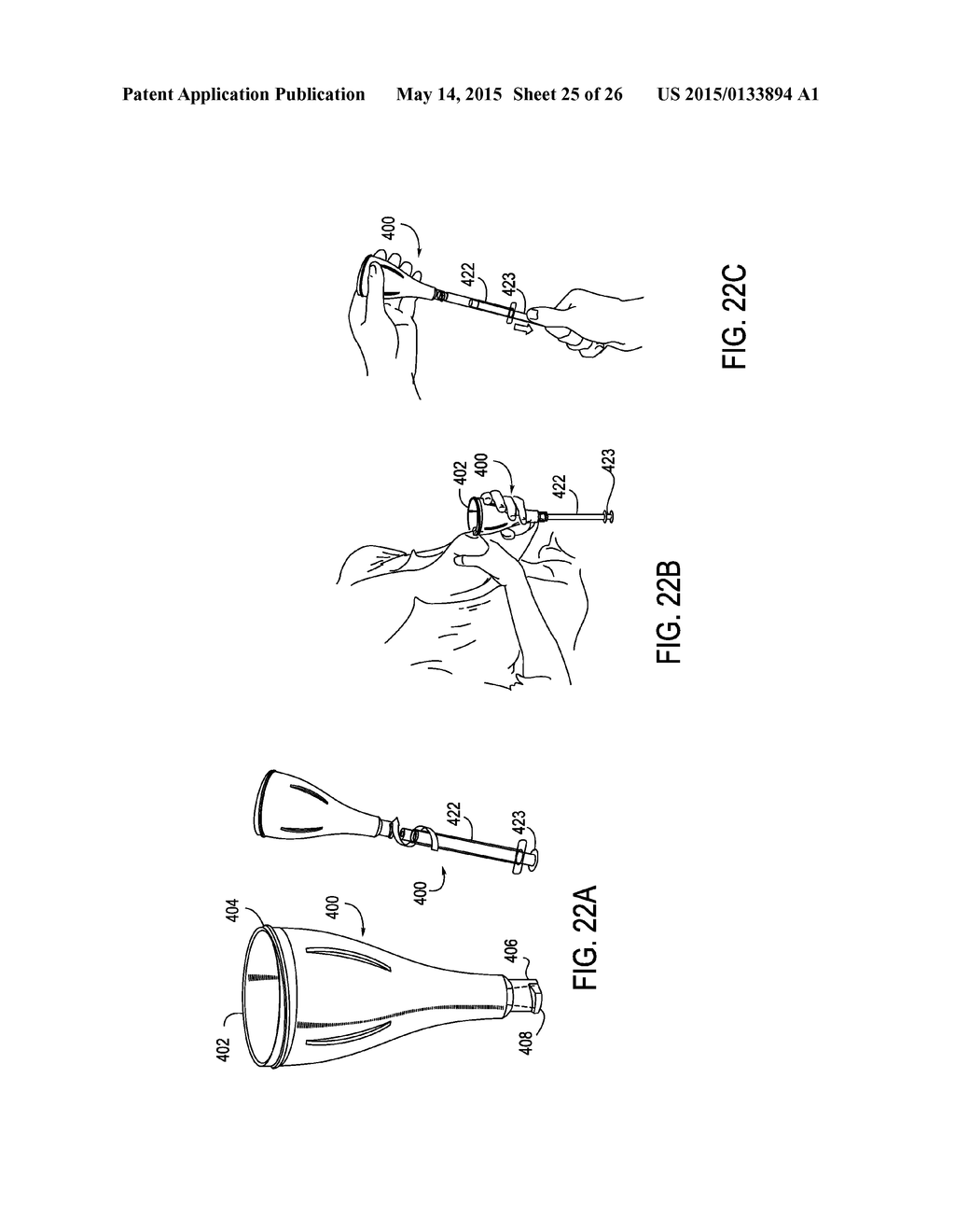 DEVICE AND METHOD FOR COLLECTING AND DISPENSING COLOSTRUM - diagram, schematic, and image 26