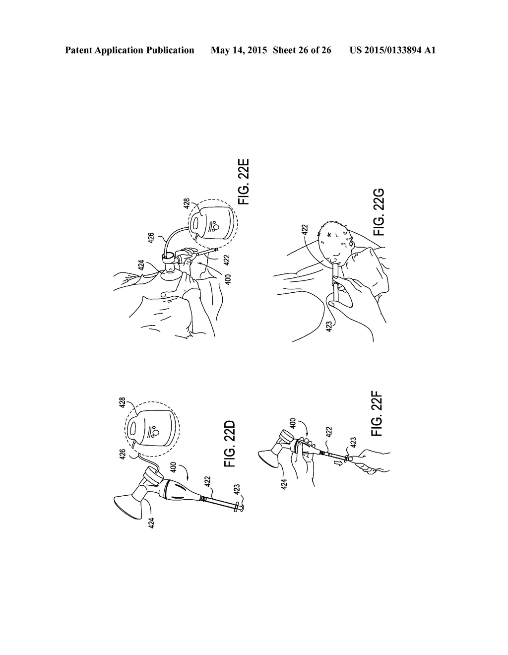 DEVICE AND METHOD FOR COLLECTING AND DISPENSING COLOSTRUM - diagram, schematic, and image 27