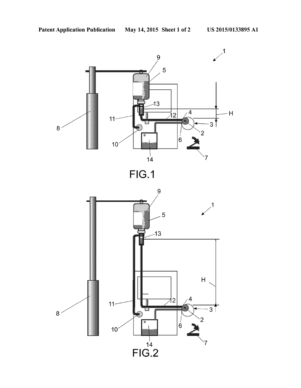 DEVICE FOR ADJUSTING THE IRRIGATION PRESSURE IN EYE OPERATIONS - diagram, schematic, and image 02