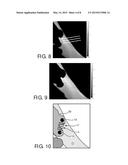 SKIN TREATMENT METHOD AND APPARATUS diagram and image