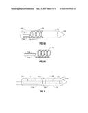 SYSTEM AND METHOD FOR ABLATION PROCEDURE MONITORING USING ELECTRODES diagram and image