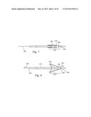 PERCUTANEOUS CATHETER-BASED ARTERIAL DENERVATION WITH INTEGRAL EMOBOLIC     FILTER diagram and image