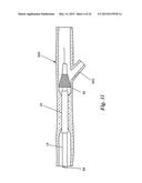 PERCUTANEOUS CATHETER-BASED ARTERIAL DENERVATION WITH INTEGRAL EMOBOLIC     FILTER diagram and image