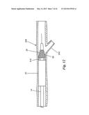 PERCUTANEOUS CATHETER-BASED ARTERIAL DENERVATION WITH INTEGRAL EMOBOLIC     FILTER diagram and image