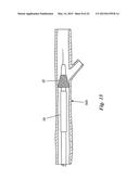 PERCUTANEOUS CATHETER-BASED ARTERIAL DENERVATION WITH INTEGRAL EMOBOLIC     FILTER diagram and image