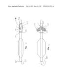 PERCUTANEOUS CATHETER-BASED ARTERIAL DENERVATION WITH INTEGRAL EMOBOLIC     FILTER diagram and image