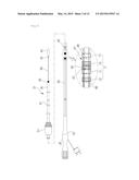 Combined Cauterization and Stent Operation Device diagram and image