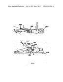 HANDHELD TRACKING SYSTEM AND DEVICES FOR ALIGNING IMPLANT SYSTEMS DURING     SURGERY diagram and image