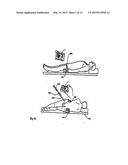 HANDHELD TRACKING SYSTEM AND DEVICES FOR ALIGNING IMPLANT SYSTEMS DURING     SURGERY diagram and image