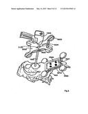 HANDHELD TRACKING SYSTEM AND DEVICES FOR ALIGNING IMPLANT SYSTEMS DURING     SURGERY diagram and image