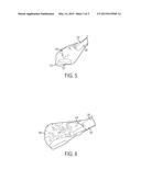 DEVICES AND METHODS FOR REMOVAL OF CALCULUS diagram and image